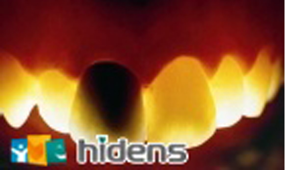 假牙(牙套)種類